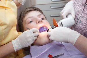 dallas kids dental sealants