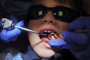 dallas kids dental emergencies