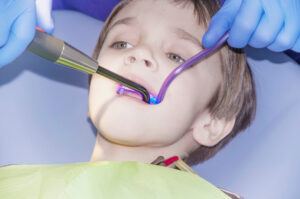 dallas laser dentistry for kids