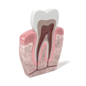 dallas kids root canal treatment