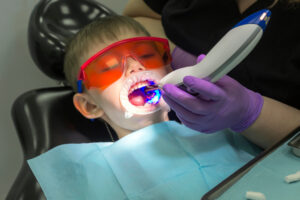 dallas root canal treatment