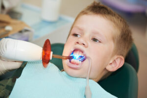 dallas kids dental fillings