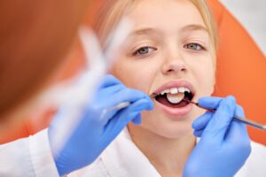 dallas dental sealants