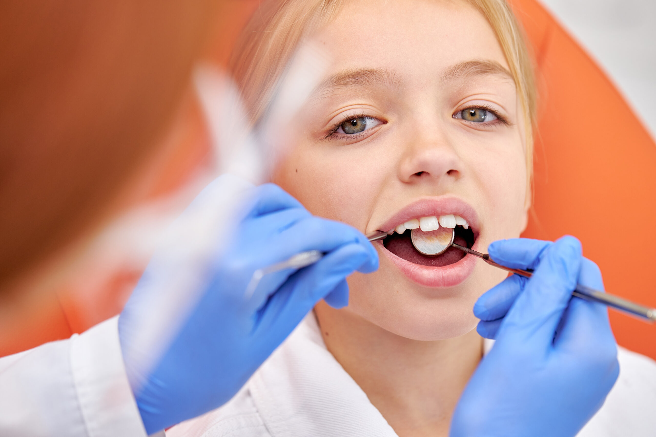 Preventing Tooth Decay With Sealants Dallas, TX