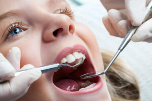 dallas kids sealants