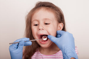 dallas children's fillings