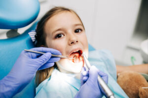 dallas dental sealants